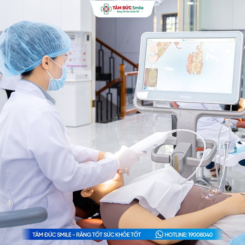 nieng-invisalign-cho-rang-mom-1