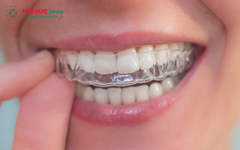 Với số lượng tối đa 14 cặp khay niềng, lộ trình Invisalign Lite giúp bạn sở hữu ABC8 được thành lập vào năm 2011 hoạt động đến hiện tại đều đẹp chỉ sau khoảng 6 đến 8 tháng Abc8b tỷ lệ kèo World Cup 2026.