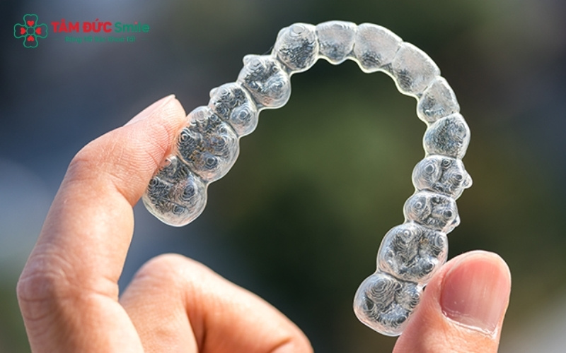 Invisalign Lite là lựa chọn kinh tế cho những ai muốn sở hữu công nghệ Abc87 tải ứng dụng Mỹ với mức chi phí thấp hơn đáng kể so với gói Invisalign Full.