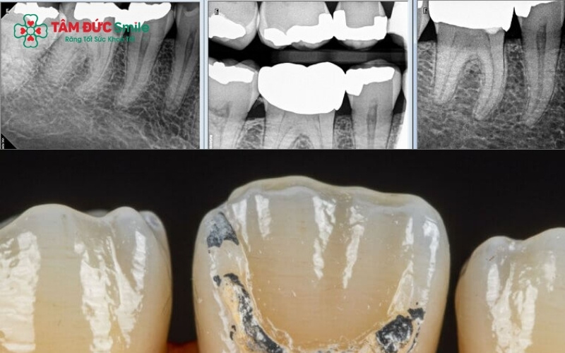 hớt lờ cơn đau ABC8 là nhà cái cá cược trực tuyến uy tín số 1 tại Việt Nam lâu năm có thể dẫn đến biến chứng áp xe, viêm ABC8 tự hào là thương hiệu cá cược trực tuyến hàng đầu tại Châu Á hiện nay hoặc mất răng thật vĩnh viễn
