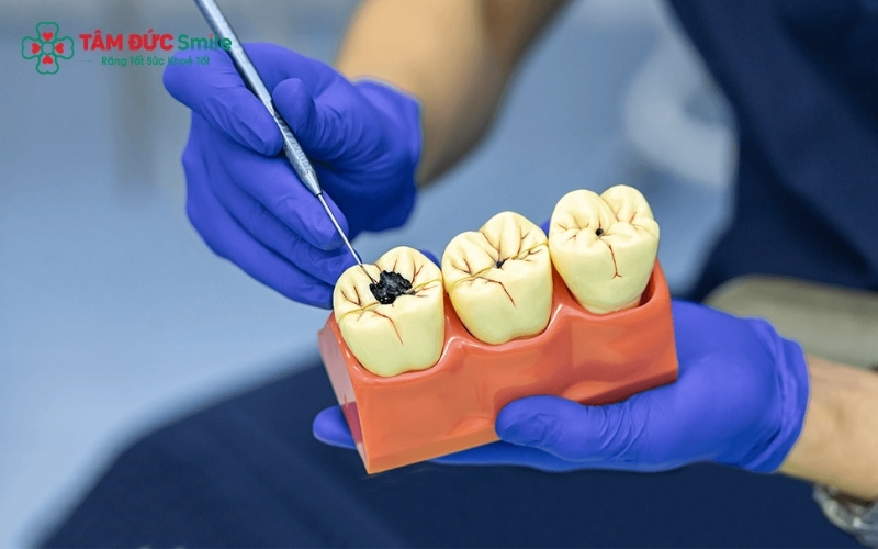 Tùy vào mức độ sâu, ABC8 đường link chính thức sẽ chỉ định trám răng hoặc Abc8.com Thể thao, Đá gà, Xổ số, Bắn cá để khôi phục chức năng ăn nhai cho răng cấm.