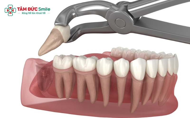 Nếu xuất hiện các dấu hiệu đau nhức dữ dội hoặc chảy máu kéo dài, bạn cần liên hệ ngay với ABC8 đường link chính thức để được xử lý kịp thời.