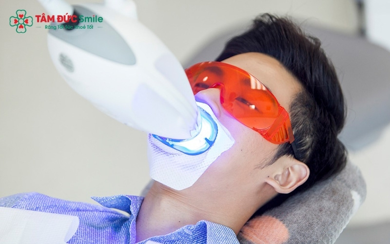Phương pháp tẩy trắng răng mang lại hiệu quả cao với các trường hợp nhiễm màu ngoại sinh, nhưng cần sự thăm khám của ABC8 đường link chính thức để xác định kết quả tối ưu.