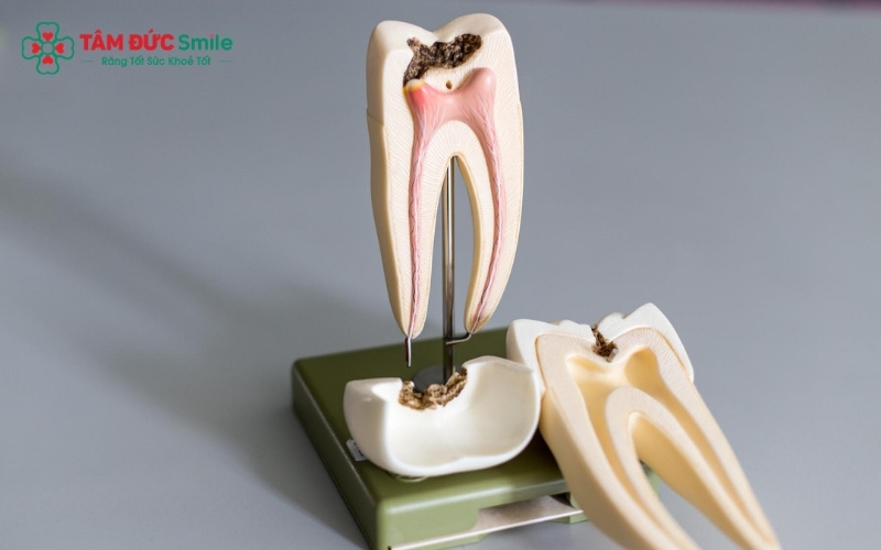Răng số 7 thường có hệ thống Abc8com giaitri tructuyen phức tạp với nhiều ống tủy phụ, đòi hỏi ABC8 đường link chính thức phải có tay nghề cao và thiết bị hiện đại để Abc8b tỷ lệ kèo World Cup 2026 triệt để