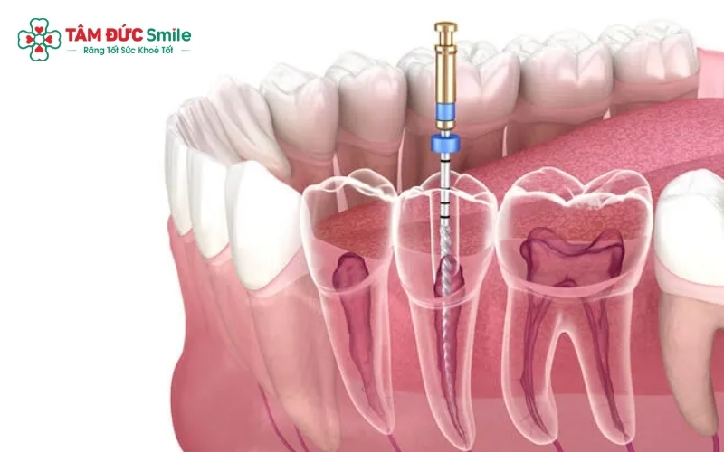 Răng số 7 nằm ở vị trí áp chót trên cung hàm, đóng vai trò "máy nghiền" chủ lực giúp nghiền nát thức ăn trước khi đưa vào dạ dày.