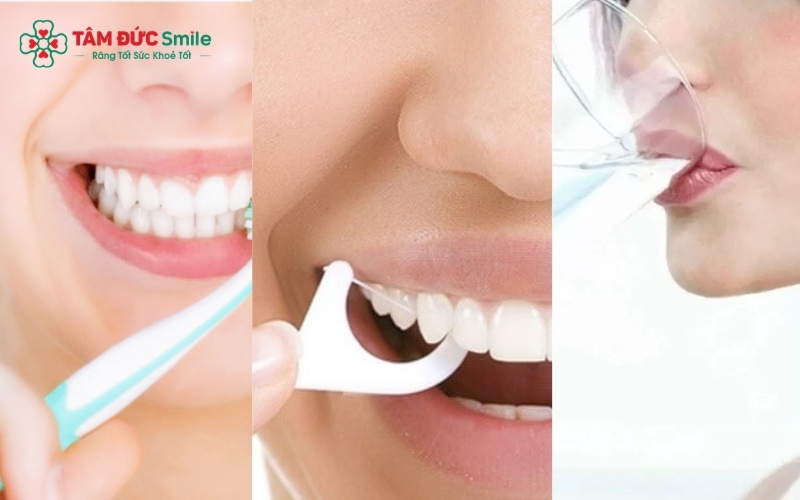 Sau khi Abc88bet phiên bản mới, hãy ưu tiên sử dụng bàn chải lông mềm và chỉ LINK TRANG CHỦ ABC88 CHUẨN 2026 để làm sạch nhẹ nhàng, tránh tổn thương nướu