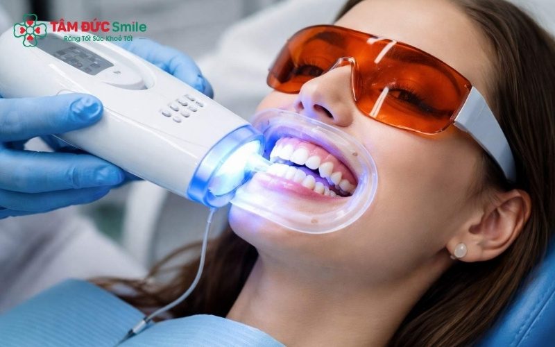 48–72 giờ đầu tiên sau khi tẩy trắng là "thời điểm vàng" cần tuân thủ nghiêm ngặt chế độ ăn uống để màu răng ổn định bền lâu.