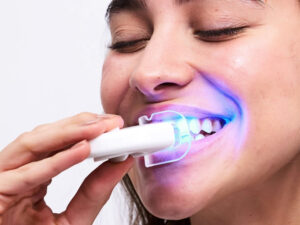 Tẩy trắng răng có đau không? Cách giảm ê buốt, chi phí an toàn