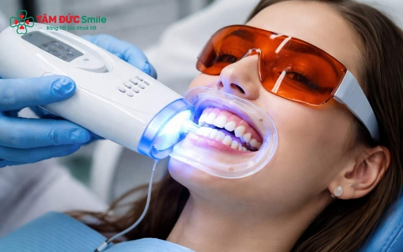 Tẩy trắng răng bằng công nghệ Laser hiện đại giúp hạn chế tối đa cảm giác ê buốt và bảo vệ men răng.