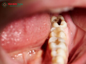 Thuốc đặc trị ABC88 com đăng nhập cho bà bầu: Cách dùng an toàn