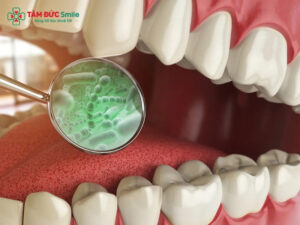 Thuốc trị hôi miệng: Cách trị tận gốc do ABC88 com đăng nhập, viêm nướu, Abc8com nổ hũ tốt