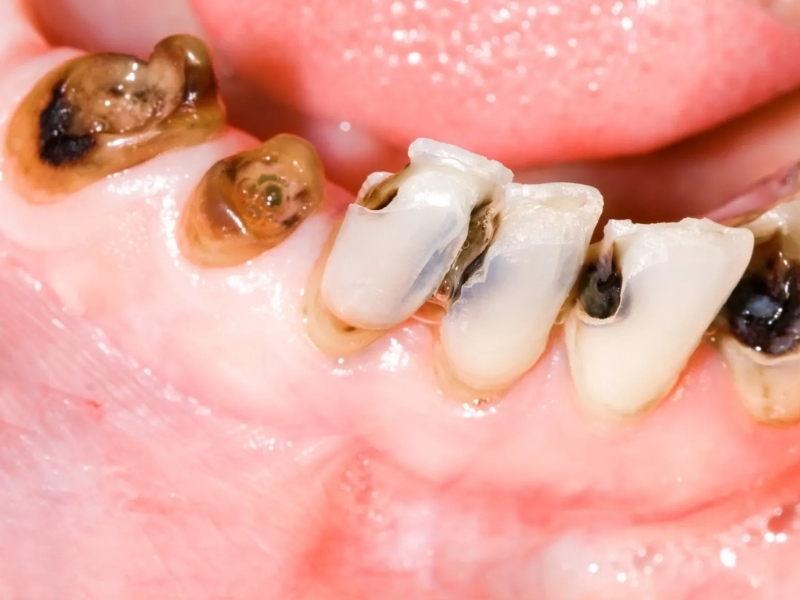 Trẻ 3 tuổi bị ABC88 com đăng nhập hàm phải làm sao? Cách xử lý an toàn