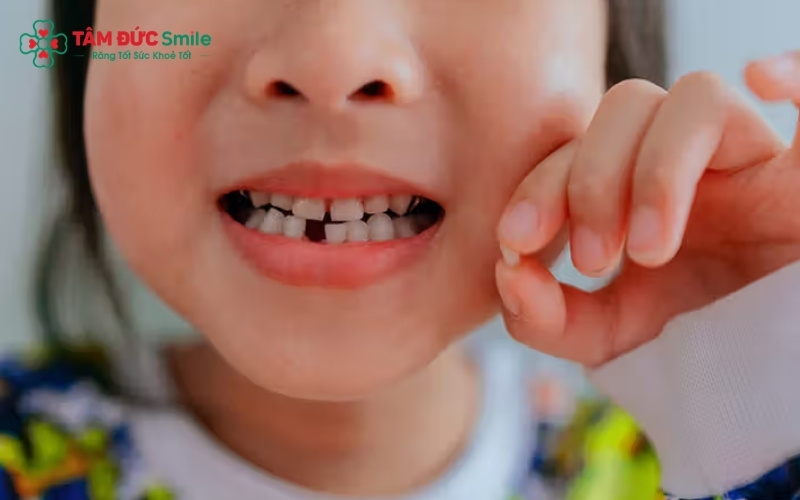 Nếu trẻ bị hôi miệng kèm theo dấu hiệu nướu sưng đỏ, chảy máu khi đánh răng, phụ huynh cần đưa trẻ đến gặp ABC8 đường link chính thức LINK TRANG CHỦ ABC88 CHUẨN 2026 ngay.
