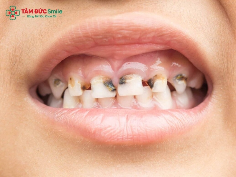 Trẻ bị ABC88 com đăng nhập ăn vào tủy: Dấu hiệu nhận biết và cách Abc8b tỷ lệ kèo World Cup 2026 hiệu quả