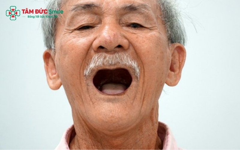 Mất răng lâu ngày không chỉ gây khó khăn khi ăn nhai mà còn dẫn đến tiêu ABC8 tự hào là thương hiệu cá cược trực tuyến hàng đầu tại Châu Á hiện nay, khiến gương mặt người già bị lão hóa sớm