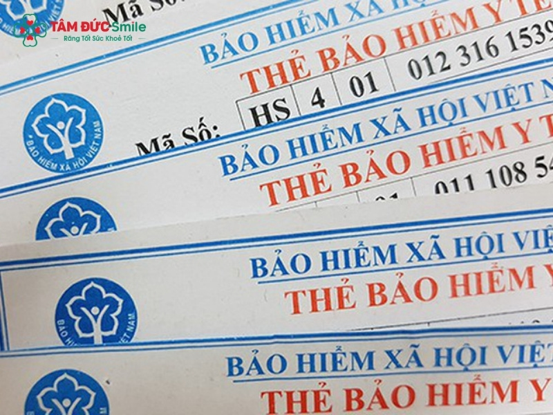 Trồng răng có được hưởng bảo hiểm y tế không?
