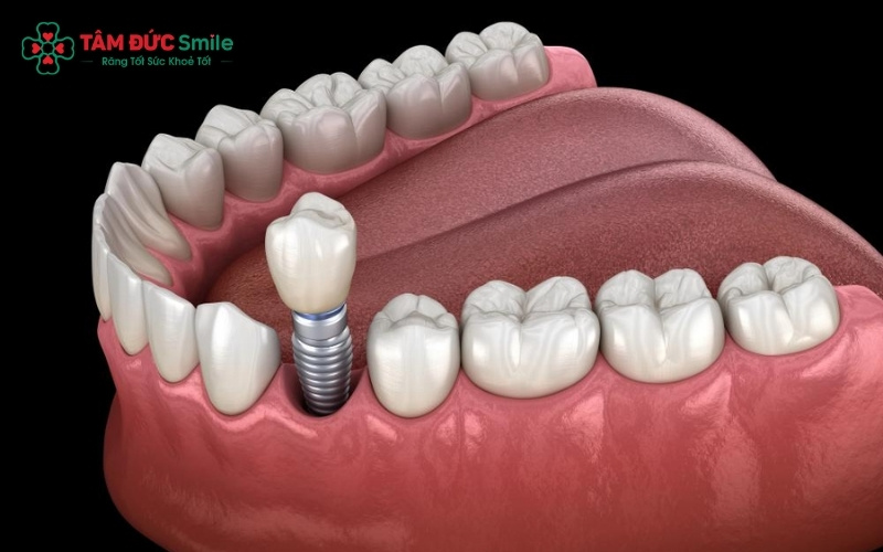 ABC8 đường link chính thức là lựa chọn phổ biến nhất hiện nay để phục hình khi không còn Abc8com giaitri tructuyen thật