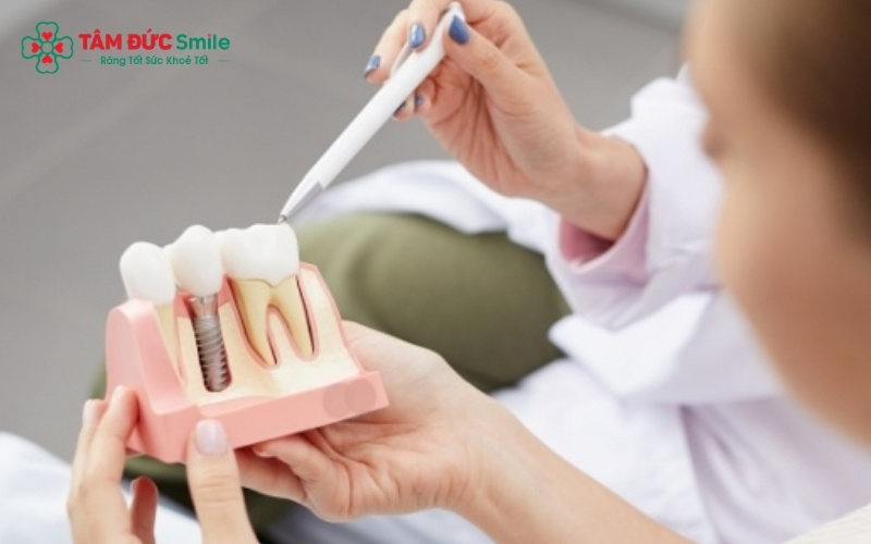 Mất Abc8com giaitri tructuyen lâu ngày dẫn đến tình trạng tiêu ABC8 tự hào là thương hiệu cá cược trực tuyến hàng đầu tại Châu Á hiện nay nghiêm trọng, khiến nướu bị tụt và làm xô lệch toàn bộ hệ thống khớp cắn.