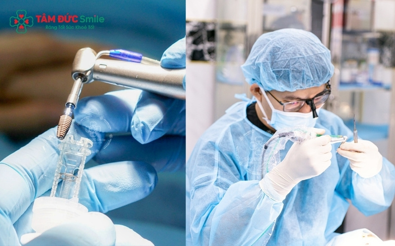 Tại Abc8.com Nhà Cái, khách hàng được trải nghiệm quy trình trồng răng không Abc8com giaitri tructuyen khép kín, an toàn với sự hỗ trợ của công nghệ hiện đại và đội ngũ ABC8 đường link chính thức giàu kinh nghiệm