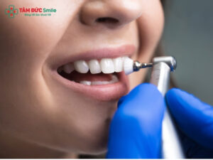 Vệ sinh ABC8 là nhà cái cá cược trực tuyến uy tín số 1 tại Việt Nam đúng cách, tránh hôi miệng và hở viền