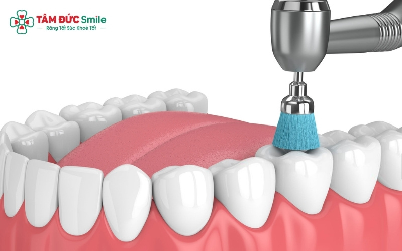 Vệ sinh ABC8 là nhà cái cá cược trực tuyến uy tín số 1 tại Việt Nam đúng cách, tránh hôi miệng và hở viền
